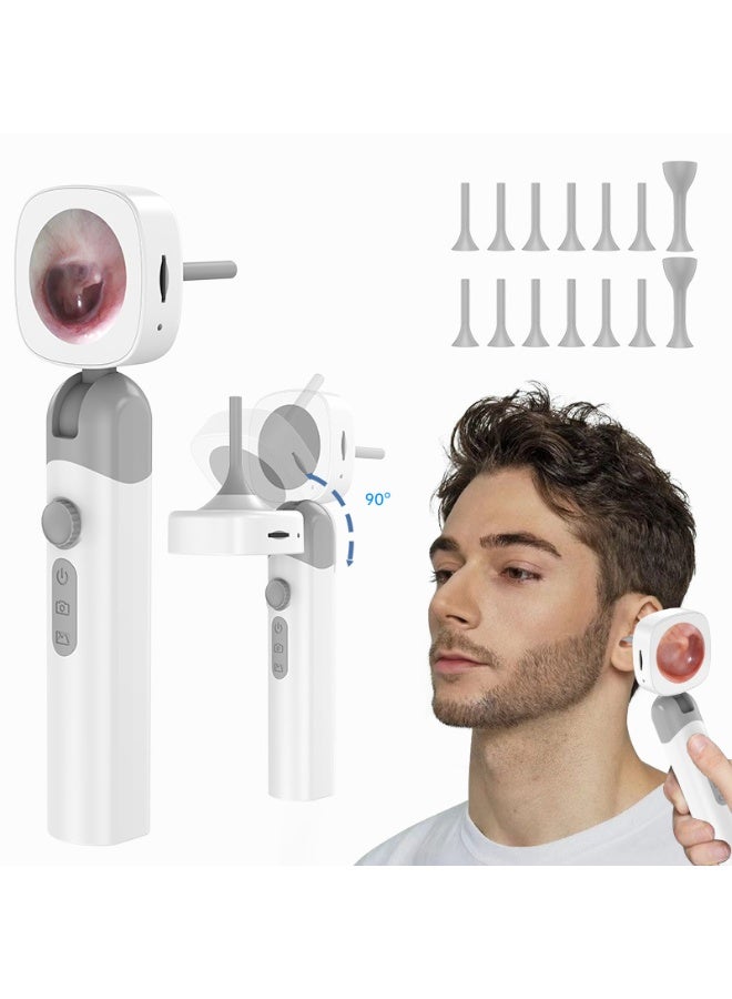 general Portable Digital Otoscope Handheld with Screen Photo Video Recording Ear Endoscope Type-C Rechargeable - Image 1